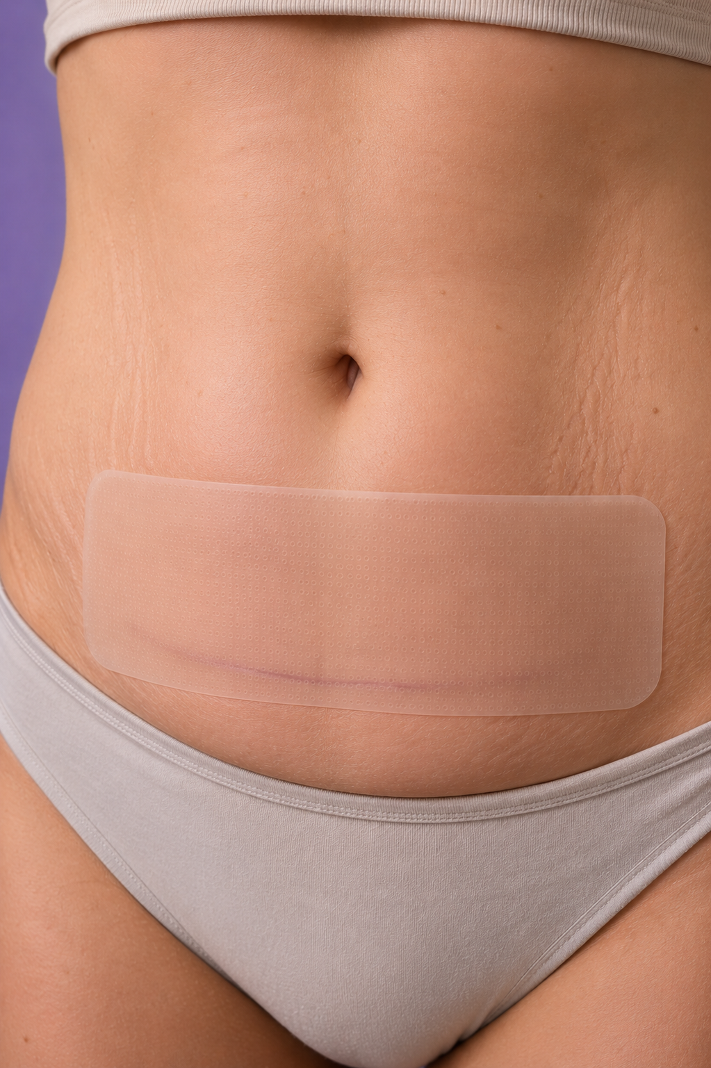 Birthly C-Scar™ Strips – Silicone Scar Strips